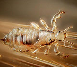 راهکارهای بهداشتی کنترل شپش در خوابگاه‌های دانشجویی